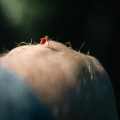 Hoe lang beschermt muggenspray met 50% DEET tegen tijgermuggen in de zomer